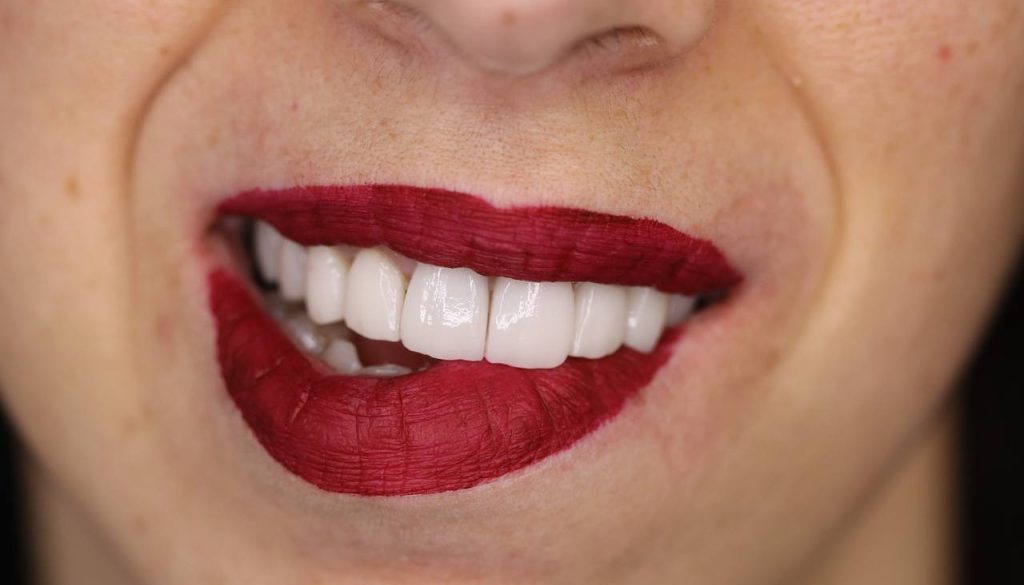 Marco e Laura Belia, creatori di sorrisi
