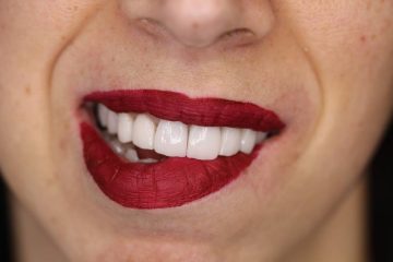 Marco e Laura Belia, creatori di sorrisi