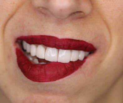 Marco e Laura Belia, creatori di sorrisi
